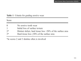 Basic Erosive Wear Examination (BEWE)

66

 
