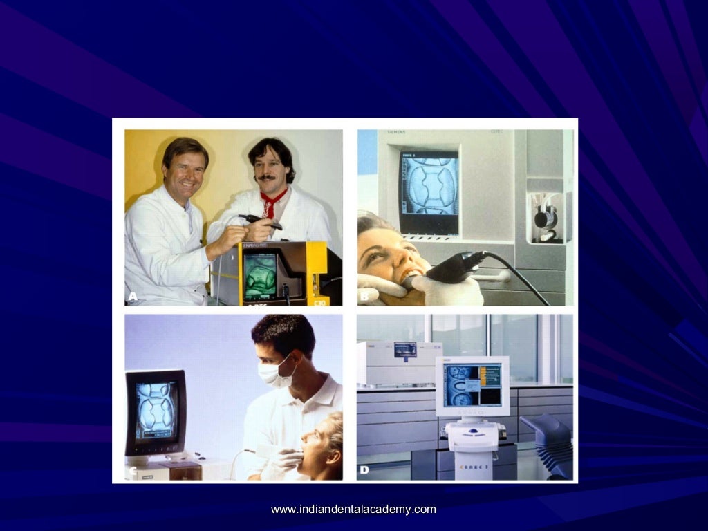 Recent advances in dental materials /certified fixed orthodontic cour…