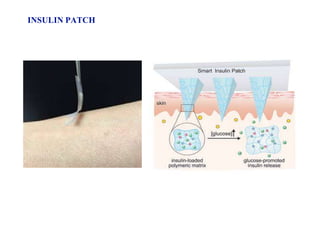 INSULIN PATCH
 