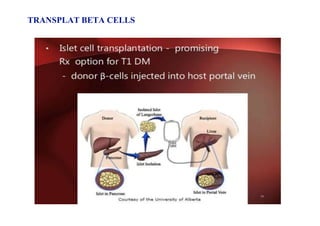 TRANSPLAT BETA CELLS
 