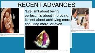 “Life isn’t about being
perfect; it’s about improving.
It’s not about achieving more,
acquiring more, or even
about actually being more.
It’s about becoming
better…better than you
were.”
― Toni Sorenson
RECENT ADVANCES
 