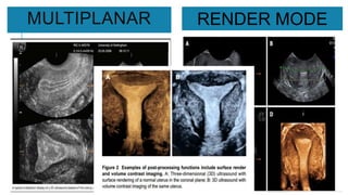 MULTIPLANAR RENDER MODE
 