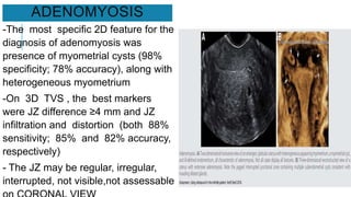 ADENOMYOSIS
-The most specific 2D feature for the
diagnosis of adenomyosis was
presence of myometrial cysts (98%
specificity; 78% accuracy), along with
heterogeneous myometrium
-On 3D TVS , the best markers
were JZ difference ≥4 mm and JZ
infiltration and distortion (both 88%
sensitivity; 85% and 82% accuracy,
respectively)
- The JZ may be regular, irregular,
interrupted, not visible,not assessable
 