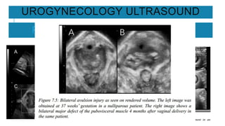 UROGYNECOLOGY ULTRASOUND
PERINEUM ANAL REGION
 
