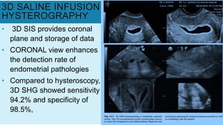 3D SALINE INFUSION
HYSTEROGRAPHY
• 3D SIS provides coronal
plane and storage of data
• CORONAL view enhances
the detection rate of
endometrial pathologies
• Compared to hysteroscopy,
3D SHG showed sensitivity
94.2% and specificity of
98.5%,
 