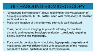 • “Ultrasound biomicroscopy” allows real time in-vivo visualization of
histologic structures OTHERWISE seen with microscopy of resected
sectioned tissue.
• Malignant invasion of the underlying stroma is well visualized
• Thus, non-invasive imaging is possible allowing for real time,
dynamic and repeated histologic evaluation ,previously requiring
biopsy, staining and microscopy.
• For example, cervical lesions including hyperplasia, dysplasia and
malignancy are well differentiated with assessment of the mucosa,
connective tissue, epithelium and microvasculature.
ULTRASOUND BIOMICROSCOPY
 