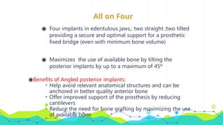 All on Four
◉ Four implants in edentulous jaws,: two straight ;two tilted
providing a secure and optimal support for a prosthetic
fixed bridge (even with minimum bone volume)
◉ Maximizes the use of available bone by tilting the
posterior implants by up to a maximum of 45º
◉Benefits of Angled posterior implants:
• Help avoid relevant anatomical structures and can be
anchored in better quality anterior bone
• Offer improved support of the prosthesis by reducing
cantilevers
• Reduce the need for bone grafting by maximizing the use
of available bone
 