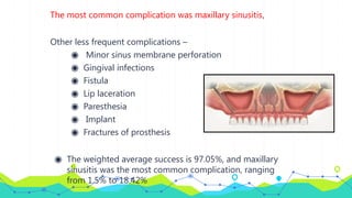 The most common complication was maxillary sinusitis,
Other less frequent complications –
◉ Minor sinus membrane perforation
◉ Gingival infections
◉ Fistula
◉ Lip laceration
◉ Paresthesia
◉ Implant
◉ Fractures of prosthesis
◉ The weighted average success is 97.05%, and maxillary
sinusitis was the most common complication, ranging
from 1.5% to 18.42%
 