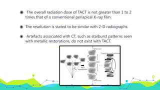 ◉ The overall radiation dose of TACT is not greater than 1 to 2
times that of a conventional periapical X-ray film.
◉ The resolution is stated to be similar with 2-D radiographs.
◉ Artefacts associated with CT, such as starburst patterns seen
with metallic restorations, do not exist with TACT.
 