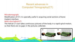 Recent advances in
Computed Tomography(CT)
Microtomograph:
Modification of CT, it is specially useful in acquiring serial sections of bone
implant interface.
Multi slice helical CT:
The helical CT scan takes continuous pictures of the body in a rapid spiral motion,
so that there are no gaps in the pictures collected.
 