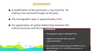 ZONOGRAPHY
◉ A modification of the panoramic x-ray machine for
making cross sectional images of the jaws.
◉ The tomographic layer is approximately 5mm.
◉ For appreciation of spatial relationship between the
critical structures and the implant site.
Limitations:
• Tomographic layers relatively thick .
• Adjacent structures blurring and
superimposition.
• Not useful for determining the differences in
bone density or for identifying disease at
 