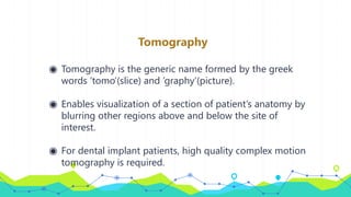 Tomography
◉ Tomography is the generic name formed by the greek
words ‘tomo’(slice) and ‘graphy’(picture).
◉ Enables visualization of a section of patient’s anatomy by
blurring other regions above and below the site of
interest.
◉ For dental implant patients, high quality complex motion
tomography is required.
 