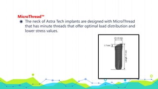 MicroThread™
◉ The neck of Astra Tech implants are designed with MicroThread
that has minute threads that offer optimal load distribution and
lower stress values.
 
