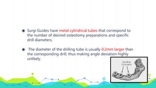 ◉ Surgi Guides have metal cylindrical tubes that correspond to
the number of desired osteotomy preparations and specific
drill diameters.
◉ The diameter of the drilling tube is usually 0.2mm larger than
the corresponding drill, thus making angle deviation highly
unlikely.
 