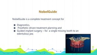 NobelGuide
NobelGuide is a complete treatment concept for
◉ Diagnostics,
◉ Prosthetic-driven treatment planning and
◉ Guided implant surgery – for a single missing tooth to an
edentulous jaw.
 