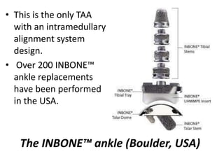 Inbone Frame Instrument Recent advances in joint arthroplasty | PPTX