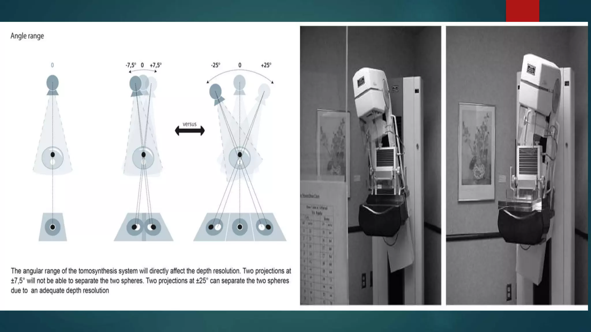 Recent advances in Mammography | PPTX
