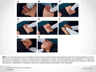 6/1/2021
Recent Advances in manipulative
medicine
38
 