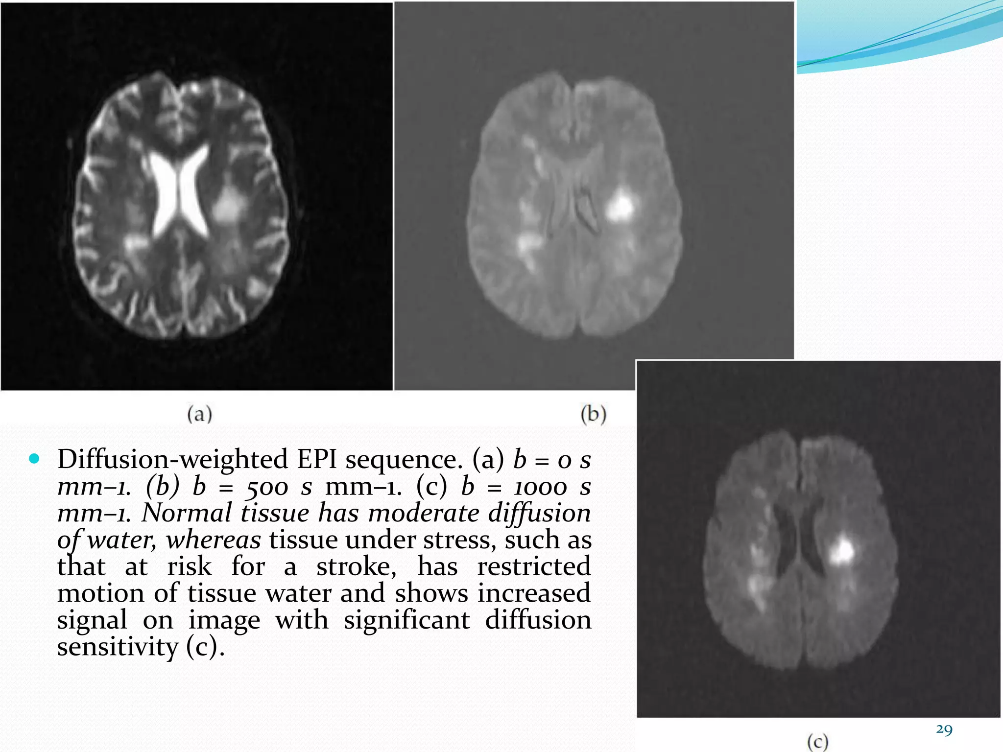 Recent Advances In MRI | PPTX