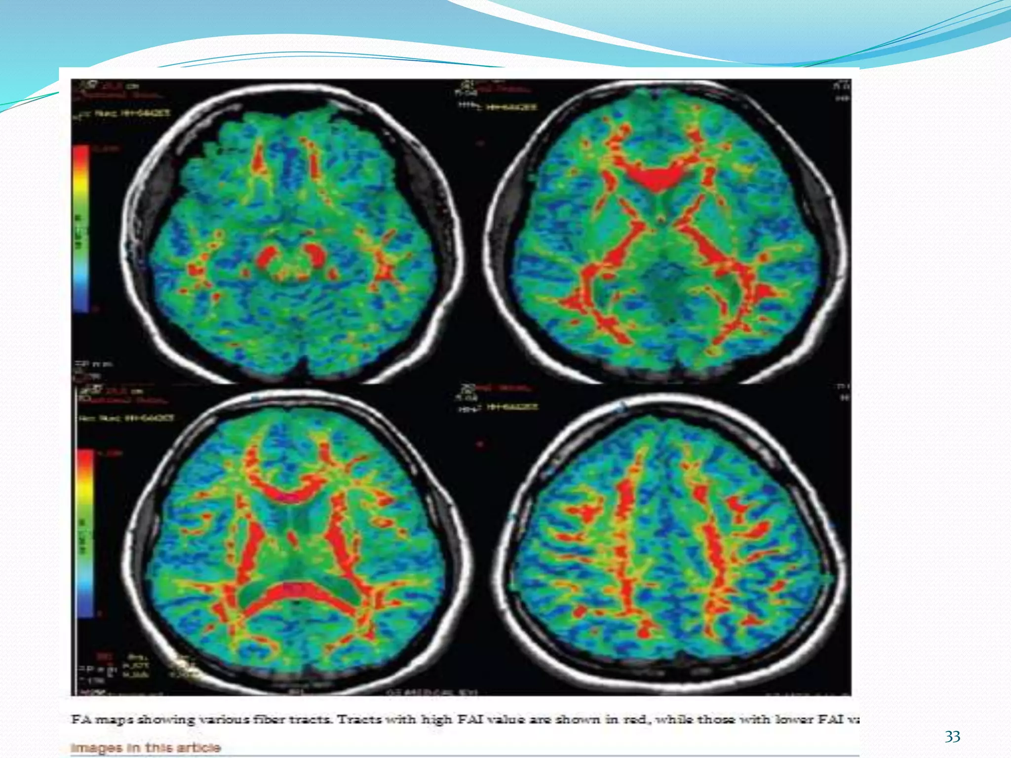 Recent Advances In MRI | PPTX
