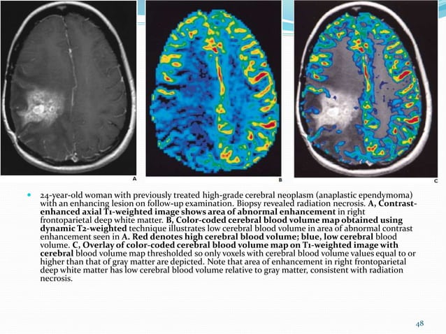 Recent Advances In MRI | PPTX | Cameras and Camcorders | Consumer ...