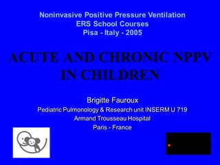 ACUTE AND CHRONIC NPPV
IN CHILDREN
Brigitte Fauroux
Pediatric Pulmonology & Research unit INSERM U 719
Armand Trousseau Hospital
Paris - France
Noninvasive Positive Pressure Ventilation
ERS School Courses
Pisa - Italy - 2005
Inserm
Institut national
de la santé et de la recherche médicale
 