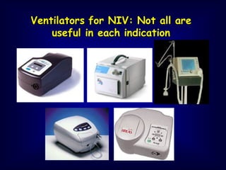 Ventilators for NIV: Not all are
useful in each indication
 