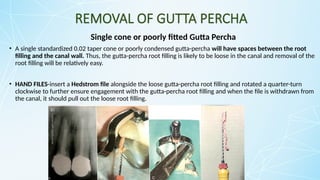REMOVAL OF GUTTA PERCHA
Single cone or poorly fitted Gutta Percha
• A single standardized 0.02 taper cone or poorly condensed gutta-percha will have spaces between the root
filling and the canal wall. Thus, the gutta-percha root filling is likely to be loose in the canal and removal of the
root filling will be relatively easy.
• HAND FILES-insert a Hedstrom file alongside the loose gutta-percha root filling and rotated a quarter-turn
clockwise to further ensure engagement with the gutta-percha root filling and when the file is withdrawn from
the canal, it should pull out the loose root filling.
 