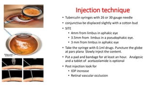 Recent advances in ophthalmology - Dr. Parag Apte | PPTX