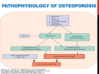 Recent advances in osteoporosis new copy | PPTX