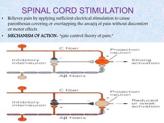 SPINAL CORD STIMULATION
• Relieves pain by applying sufficient electrical stimulation to cause
paresthesias covering or overlapping the area(s) of pain without discomfort
or motor effects
• MECHANISM OF ACTION- “gate control theory of pain,”
 