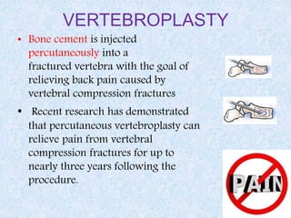 VERTEBROPLASTY
L2
• Bone cement is injected
percutaneously into a
fractured vertebra with the goal of
relieving back pain caused by
vertebral compression fractures
• Recent research has demonstrated
that percutaneous vertebroplasty can
relieve pain from vertebral
compression fractures for up to
nearly three years following the
procedure.
 