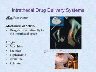Intrathecal Drug Delivery Systems
AKA: Pain pump
Mechanism of Action:
• Drug delivered directly to
the intrathecal space
Drugs:
• Morphine
• Baclofen
• Bupivacaine
• Clonidine
• Ketamine
http://www.medtronic.com/IN/images/intro_intrathecal1.
gif
 