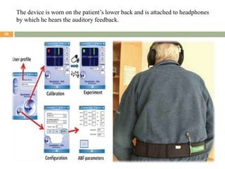 The device is worn on the patient’s lower back and is attached to headphones
by which he hears the auditory feedback.
26

12/8/2013

 