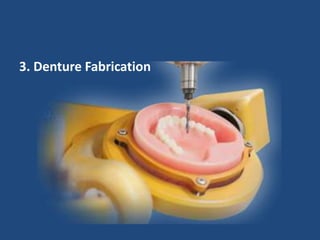 3. Denture Fabrication
 