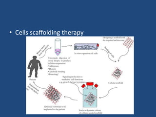 • Cells scaffolding therapy
 