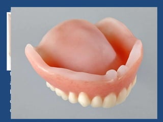 The selected material must
a) minimize bone resorption
b) protect supporting gingival tissues
c) provides good surface condition that is can enable to
clinical adjustment.
Materials include in this family of Denture liners are
those in the family of Acrylic Resins.
a) Dentimex BV
b) Perform
c) Dimethyl polysiloxanes (DMPS-Flexor)
d) Ethylene Vinyl Acetate Copolymers
 