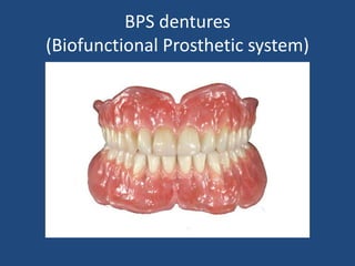 BPS dentures
(Biofunctional Prosthetic system)
 