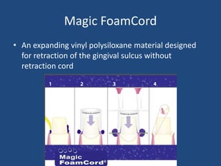 Magic FoamCord
• An expanding vinyl polysiloxane material designed
for retraction of the gingival sulcus without
retraction cord
 