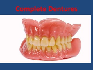 Complete Dentures
 
