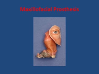Maxillofacial Prosthesis
 