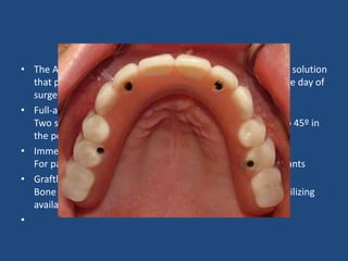 • The All-on-4® treatment concept is a cost-efficient, graftless solution
that provides patients with a fixed full-arch prosthesis on the day of
surgery.
• Full-arch rehabilitation with only four implants
Two straight anterior implants and two implants tilted up to 45º in
the posterior
• Immediate Function (fixed provisional bridge)
For patients meeting criteria for immediate loading of implants
• Graftless procedure
Bone grafting is avoided by tilting the posterior implants, utilizing
available bone
•
 