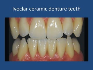 Ivoclar ceramic denture teeth
 