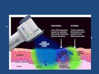 Velscope for Detection of Oral Cancer
• The Velscope shines a blue light from a hand-
held device on the tissue of the mouth.
Normal tissue absorbs the light and re-emits a
pale green light. Abnormal tissue appears to
be dark or a dark brown color.
 