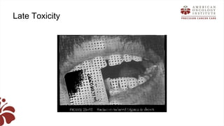 Recent advances in radiation oncology final (1) | PPTX