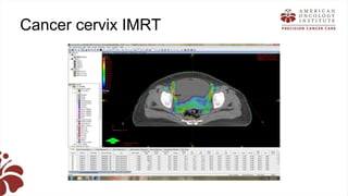 Recent advances in radiation oncology final (1) | PPTX