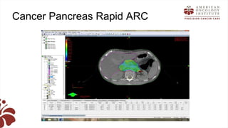 Recent advances in radiation oncology final (1) | PPTX
