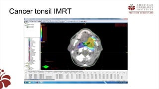 Recent advances in radiation oncology final (1) | PPTX