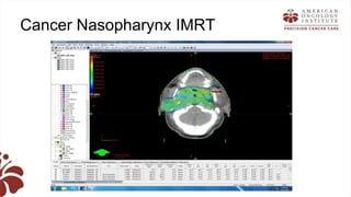 Recent advances in radiation oncology final (1) | PPTX