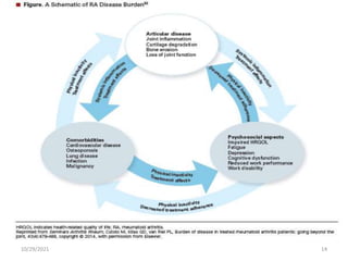 Recent advances in rheumatoid arthritis | PPTX